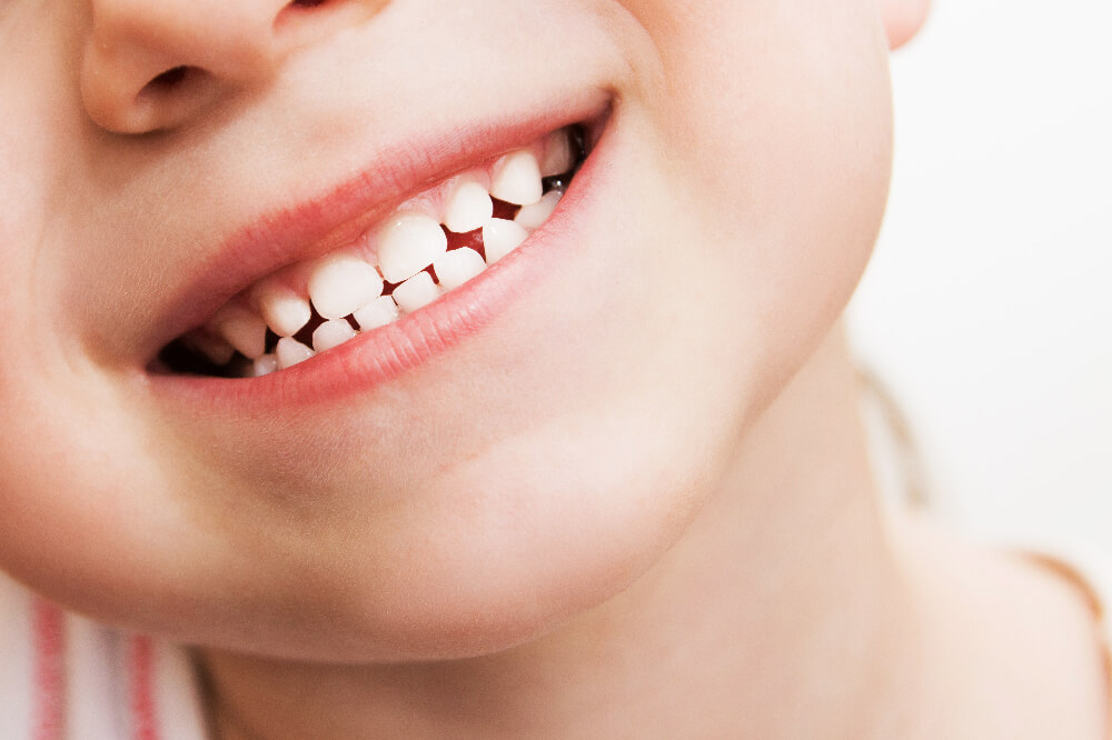 Top 5 Ways To Keep Your Child's Teeth Healthy