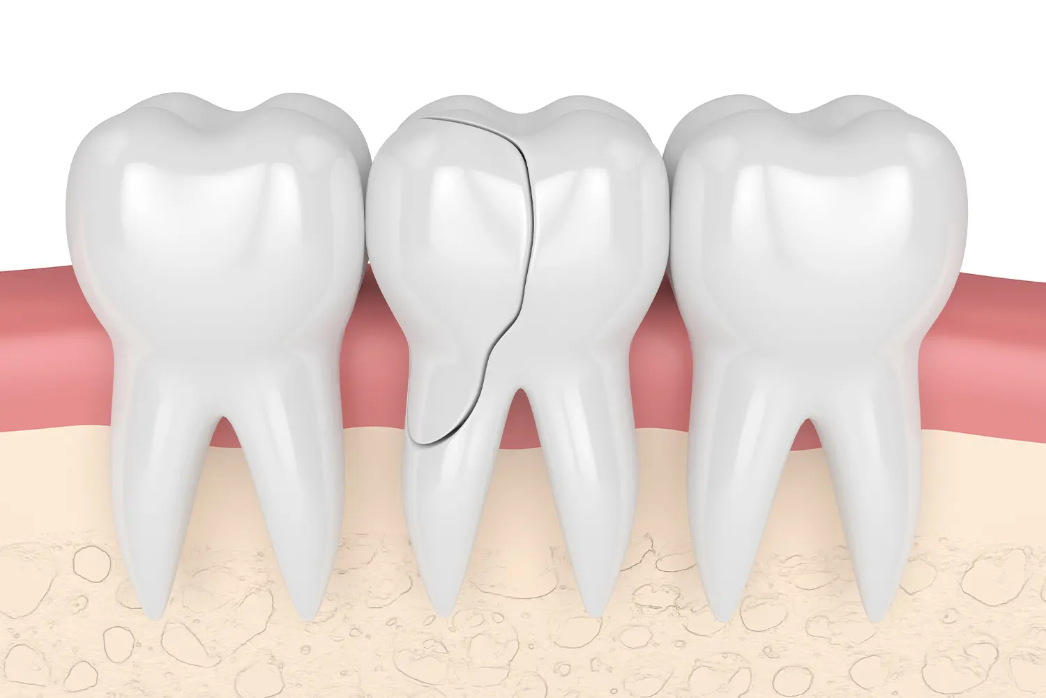 Signs Your Child Should See an Emergency Dentist